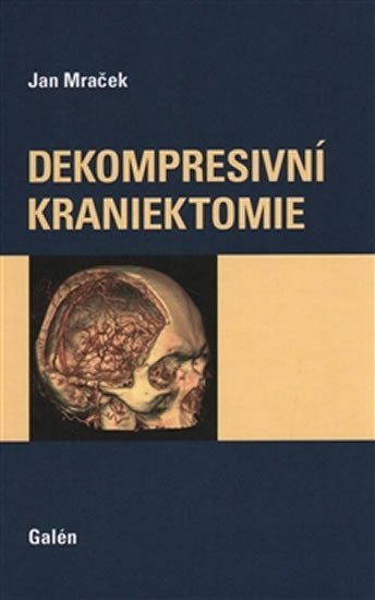 Levně Dekompresivní kraniektomie - Jan Mraček