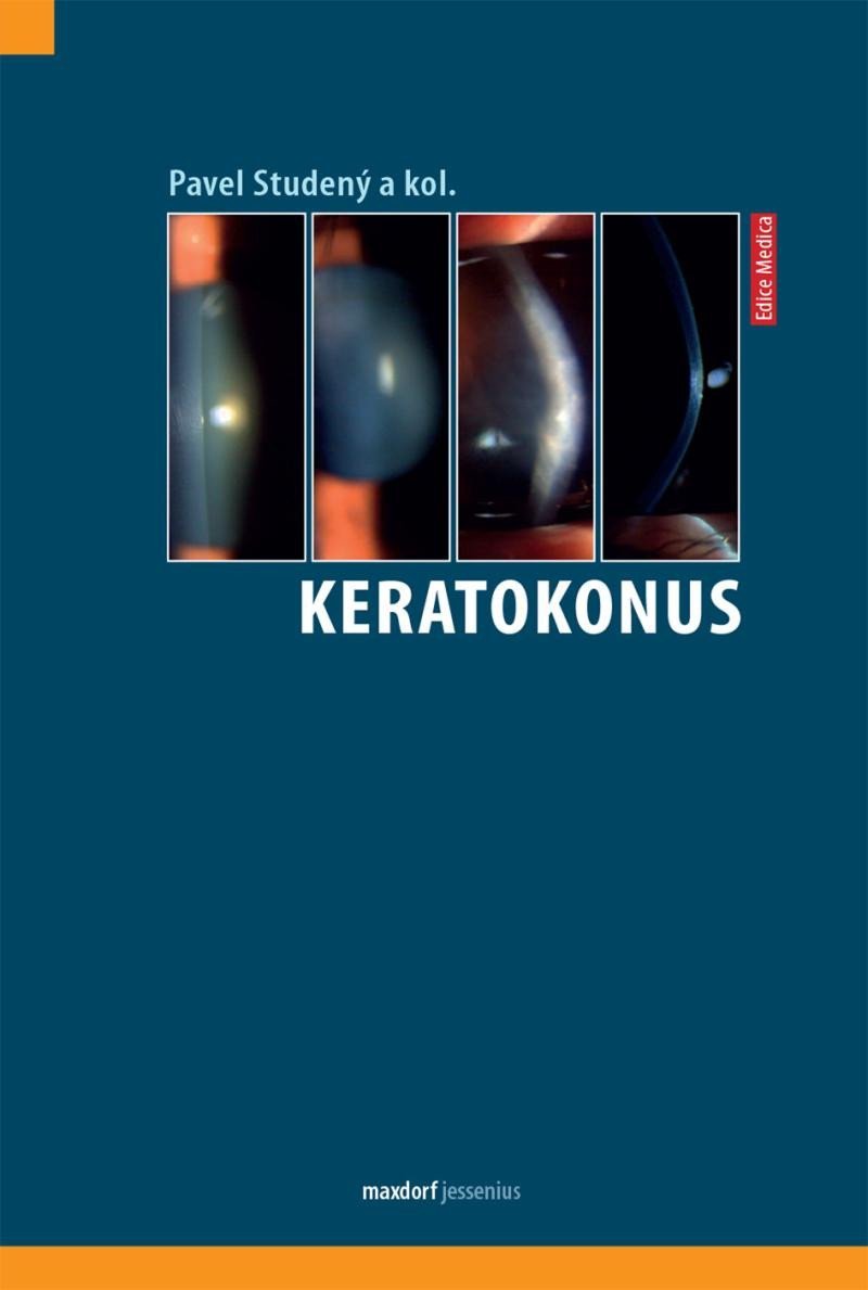 Keratokonus - Pavel Studený