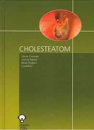 Cholesteatom