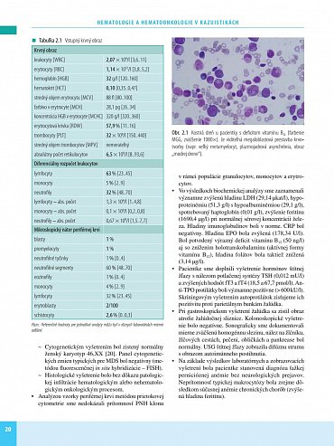 Náhled Hematologie a hematoonkologie v kazuistikách