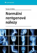 Normální rentgenové nálezy