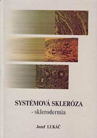 Systémová skleróza - Sklerodermia