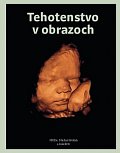 Tehotenstvo v obrazoch