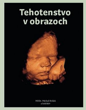 Tehotenstvo v obrazoch