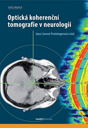 Optická koherenční tomografie v neurologii