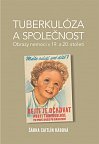 Tuberkulóza a společnost - Obrazy nemoci v 19. a 20. století