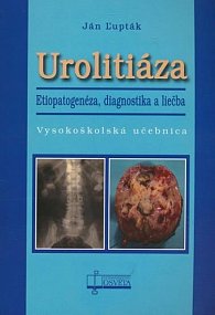 Urolitiáza: Etiopatogenéza, diagnostika a liečba