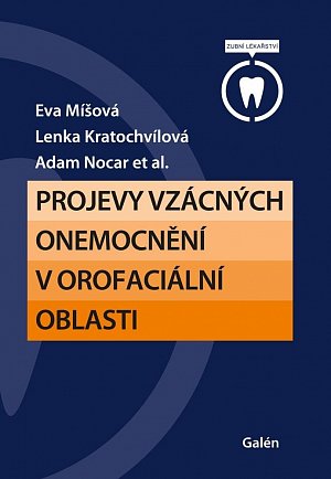 Projevy vzácných onemocnění v orofaciální oblasti