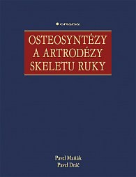 Osteosyntézy a artrodézy skeletu ruky