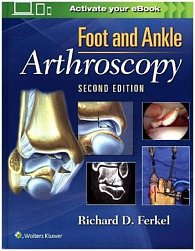 Foot & Ankle Arthroscopy, 2nd Ed.