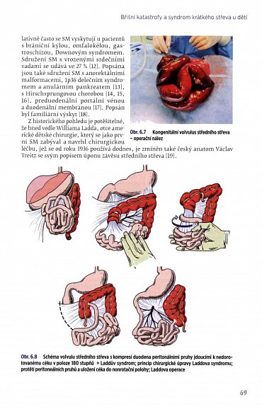 Náhled Koloproktologie