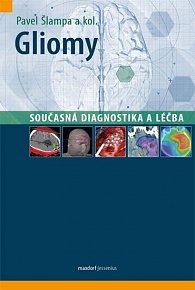 Gliomy - Současná diagnostika a léčba, 1.  vydání