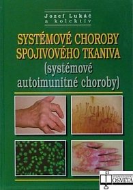 Systémové choroby spojivového tkaniva (systémové autoimunitné choroby)