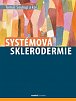 Systémová sklerodermie