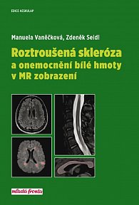 Roztroušená skleróza a onemocnění bílé hmoty v MR zobrazení