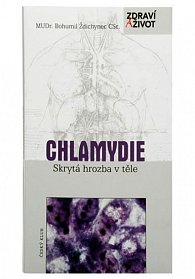 Chlamydie - skrytá hrozba v těle - 2. vydání