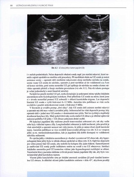 Náhled Ultrazvuk hrudníku v klinické praxi