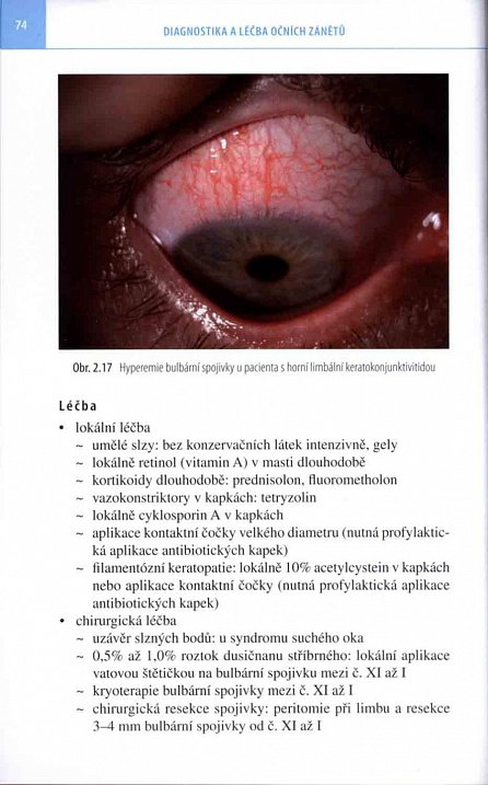 Náhled Diagnostika a léčba očních zánětů