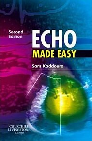 Echo Made Easy (2nd)