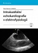 Intrakardiální echokardiografie v elektrofyziologii + DVD