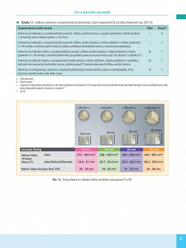Náhled Transkatétrová implantace chlopní v instruktivních kazuistikách