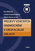 Projevy vzácných onemocnění v orofaciální oblasti