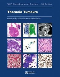 Thoracic tumours: WHO Classification of Tumours (Medicine) 5th Edition