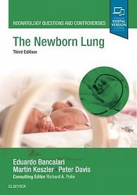 The Newborn Lung : Neonatology Questions and Controversies