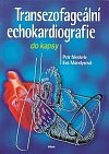 Transezofageální echokardiografie