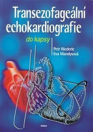 Transezofageální echokardiografie