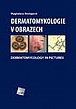 Dermatomykologie v obrazech - Dermatomycology in Pictures