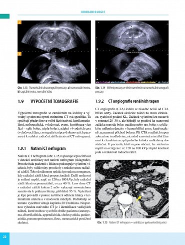 Náhled Uroradiologie