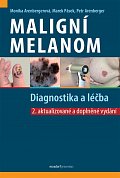 Maligní melanom - Diagnostika a léčba, 2.  vydání