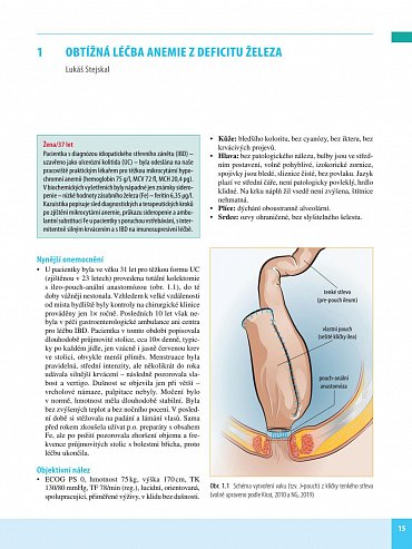 Náhled Hematologie a hematoonkologie v kazuistikách