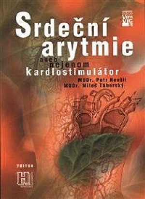 Srdeční arytmie aneb nejenom kardiostimulátor