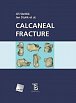 Calcaneal fracture