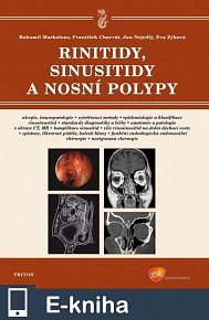 Rinitidy, sinusitidy a nosní polypy (E-KNIHA)