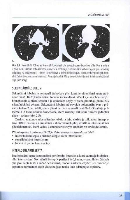 Náhled Intersticiální plicní procesy - Od etiopatogeneze přes radiologický obraz k histopatologické diagnóze
