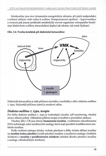 Náhled Dítě s autoimunitní endokrinopatií v ambulanci (nejen) praktického dětského lékaře