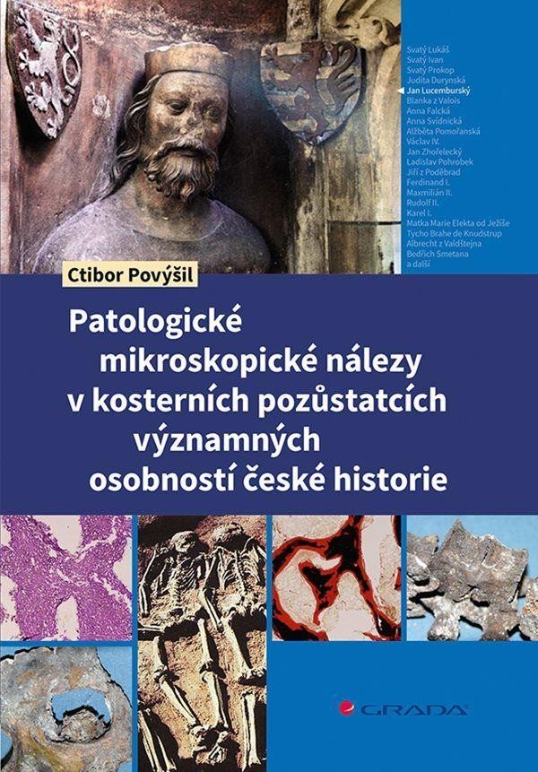 Patologické mikroskopické nálezy v kosterních pozůstatcích významných osobností české historie - Povýšil Ctibor