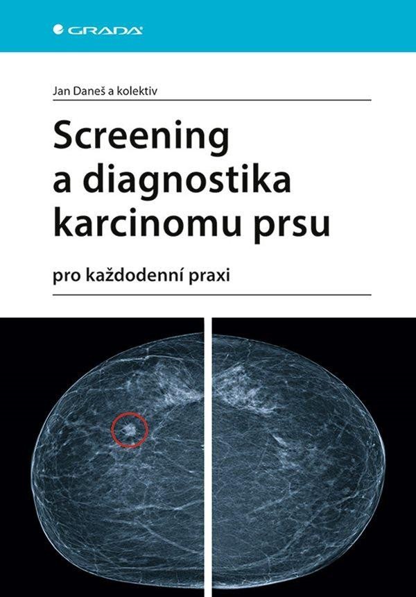 Levně Screening a diagnostika karcinomu prsu pro každodenní praxi - Jan Daneš