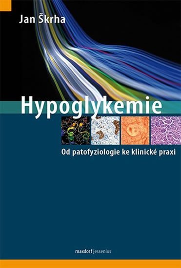 Levně Hypoglykemie - Od patofyziologie ke klinické praxi - Jan Škrha