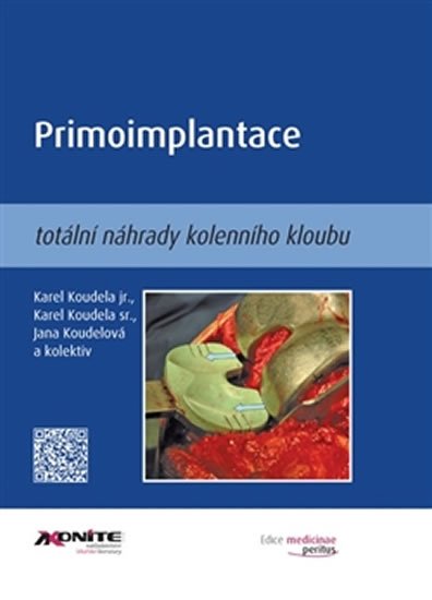 Primoimplantace totální náhrady kolenního kloubu - Karel jr. Koudela