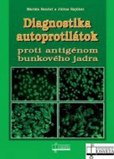 Levně Diagnostika autoprotilátok proti antigénom bunkového jadra - Marián Benčat; Július Rajčáni