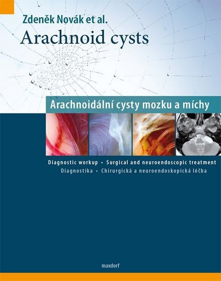 Levně Arachnoid cysts - Arachnoidální cysty mozku a míchy - Zdeněk Novák