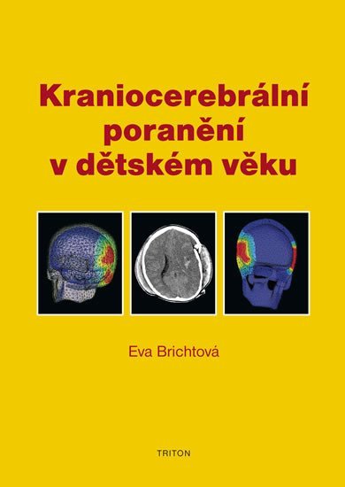 Levně Kraniocerebrální poranění v dětském věku - Eva Brichtová