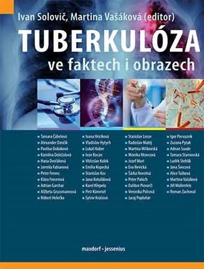 Tuberkulóza ve faktech i obrazech - Ivan Solovič