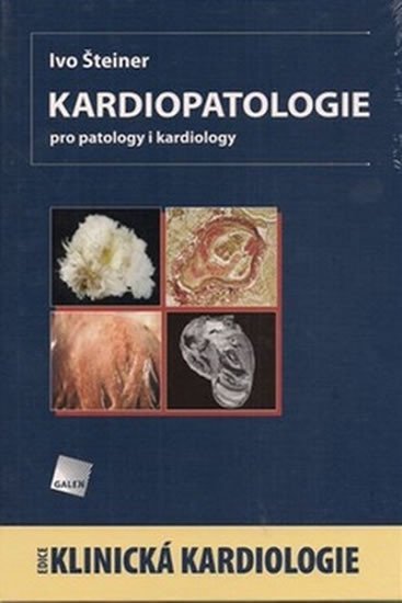 Levně Kardiopatologie - Ivo Šteiner
