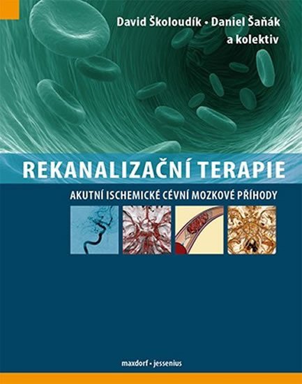 Levně Rekanalizační terapie - Akutní ischemické cévní mozkové příhody - David Školoudík