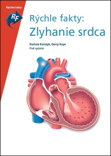 Levně Rýchle fakty: Zlyhanie srdca - Dariusz Korczyk; Gerry Kaye